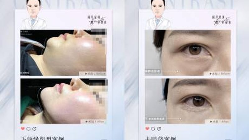 医美产品批发代理条件