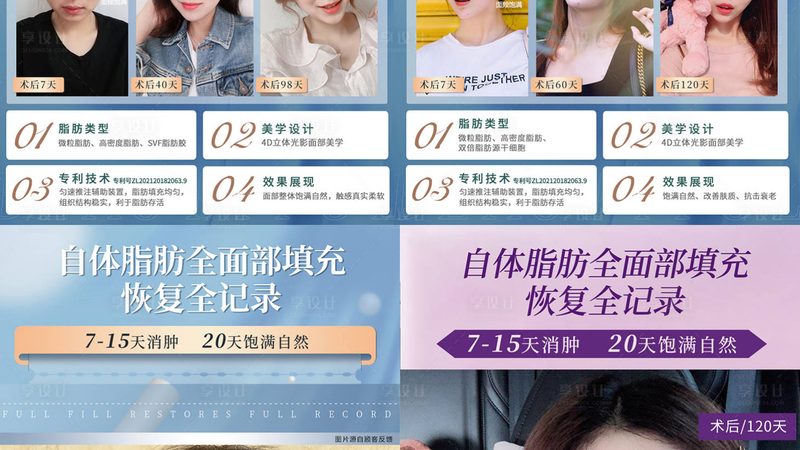 玻尿酸填充：揭秘脸颊填充的安全性与注意事项