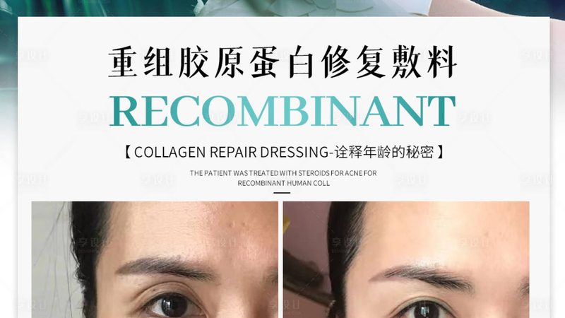 埋线提升PDO线价格乱象背后：厂家直销的真实逻辑