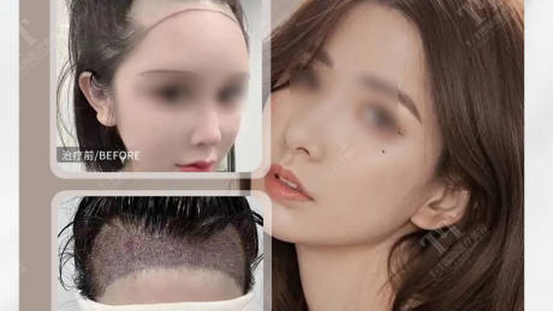 揭秘医美产品批发代理加盟：费用构成与避坑指南