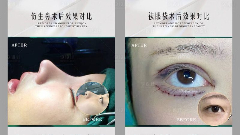 医美咨询师面试，揭秘专业之路的五大步骤