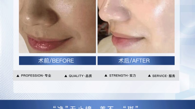 环保材料是皮肤管理店装修的第一道防线