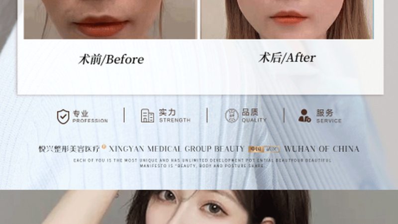 水光针注射，揭秘其专业操作流程