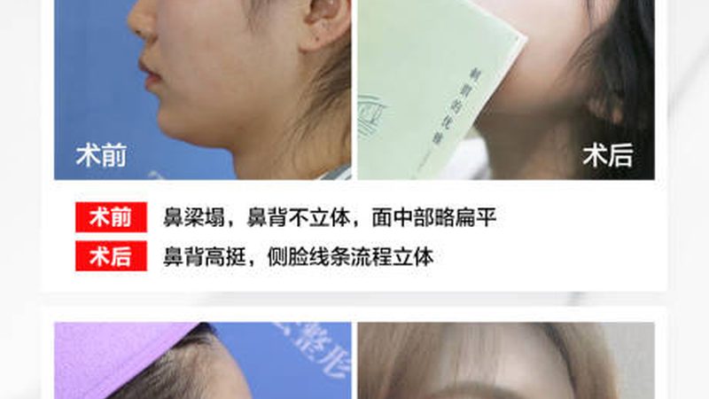双下巴的真相：瘦脸面膜到底在贴什么