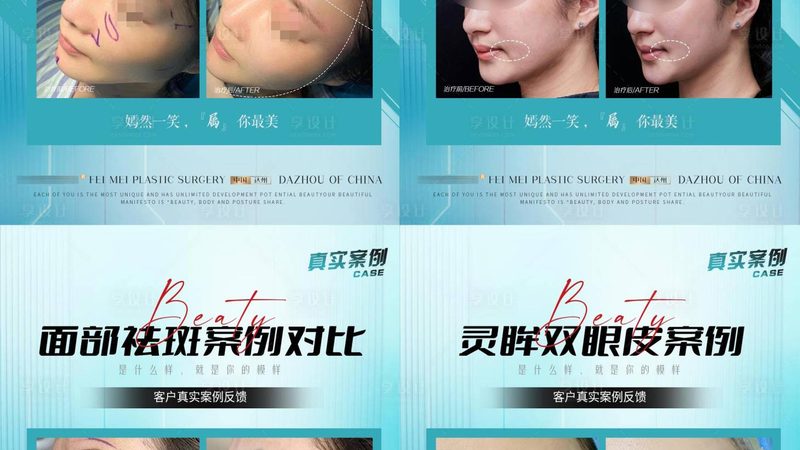 成都肉毒素下颌缘提升：揭秘技术原理与选择要点