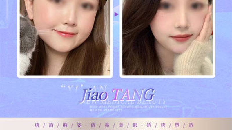 美容店加盟埋线提升项目：揭秘其原理与优势**