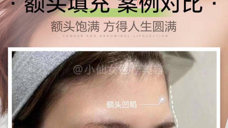 注射美容价格与医院等级：揭秘背后的真相