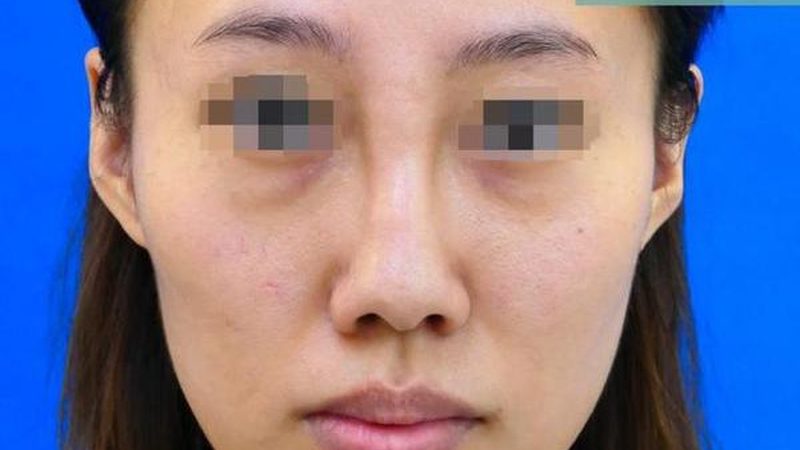 抗衰按摩手法，为什么越按脸越垮